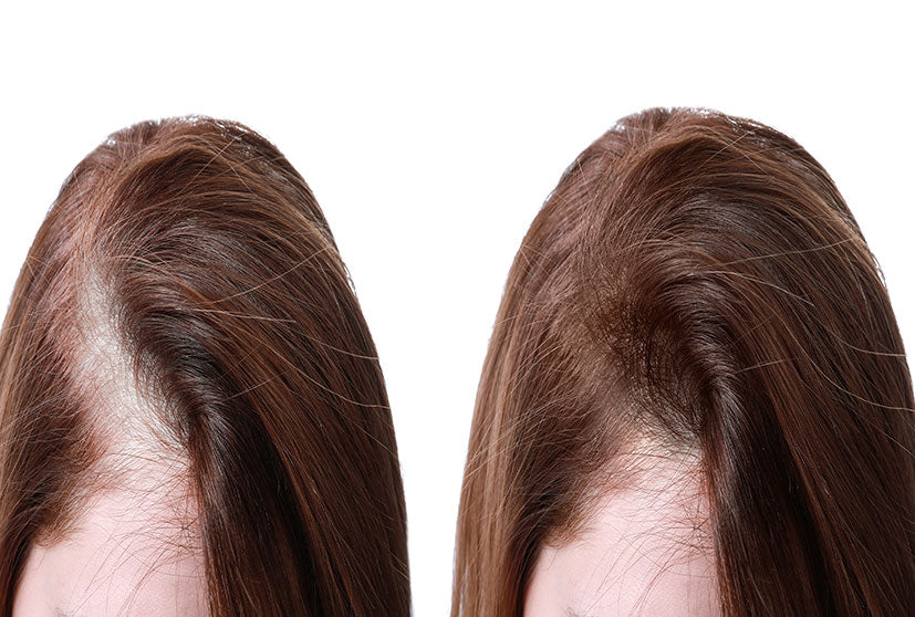 Top 4 Advantages Of Choosing A Mesh Hair Integration System